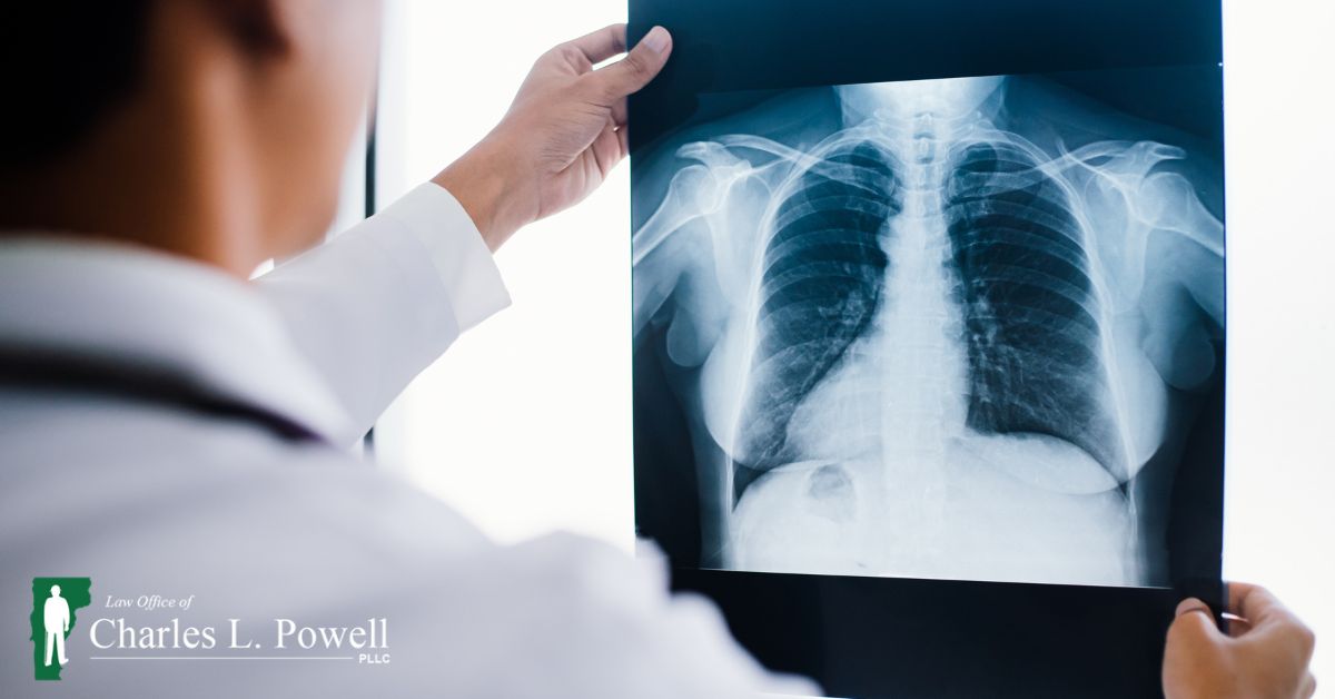 doctor looking at an x-ray